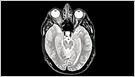 Bill Gates apoya el Premio AI de Alzheimer, que ofrece un equipo que hace que AI sea 1 millón de USD "Acelere los descubrimientos innovadores de los datos existentes de Alzheimer" (Stephen Morris/Financial Times)