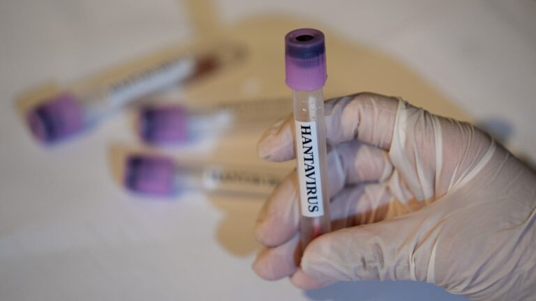 Según los CDC, actualmente no hay casos de hantavirus en Estados Unidos y 41 personas están bajo seguimiento.